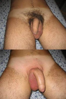 before and after waxing cock hair