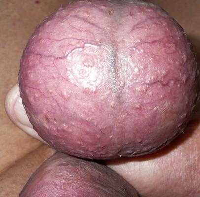 My balls closeup