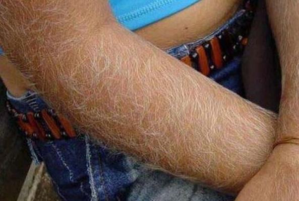 women with hairy arms