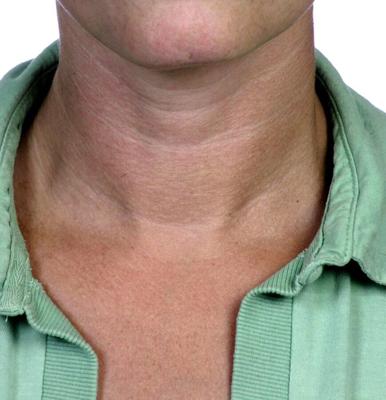 fetiche del cuello