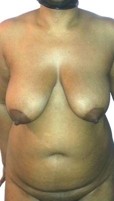 GROS SEINS LATINS