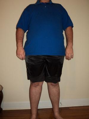 My pre weight loss pictures.