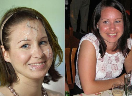 Antes Depois da Gozada Facial