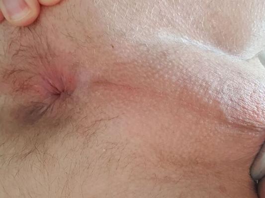 ass hole and relaxed dick up close