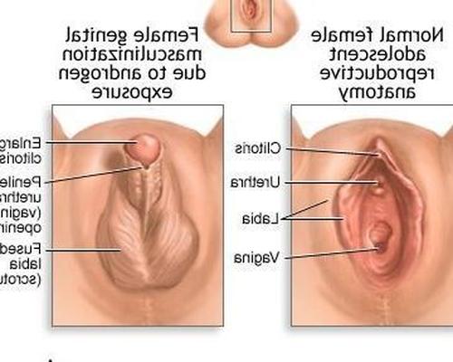 Femmes musclées