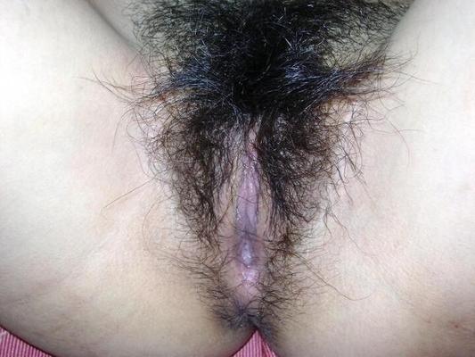 Very Hairy Japanese Lady