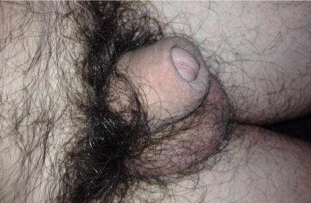 mi pene