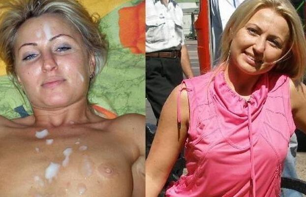 Antes y Después de Tratamientos Faciales 25