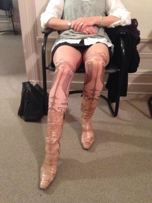 Inconnue - collants - pantyhose - panties - upskirt  (suite )