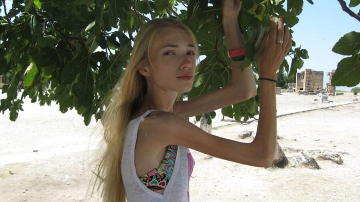 skinny amateur hottie anorexic