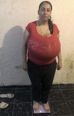 Gigantomastia, maman latina aux seins énormes